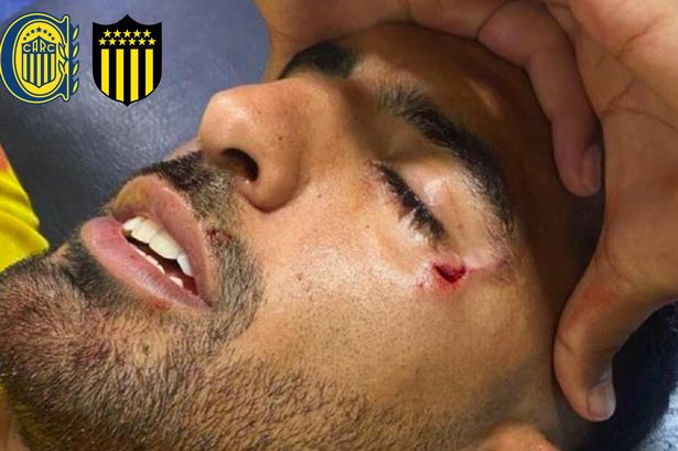 Footballer left pouring with blood after fan at Copa Libertadores launches rock onto pitch