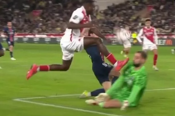 PSG star left ‘inches away from losing his eye’ in Ligue 1 horror challenge